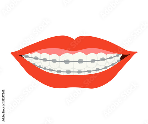 A smile with braces is drawn in a flat style. Healthy smile, braces, lips. Hand drawn vector illustration.