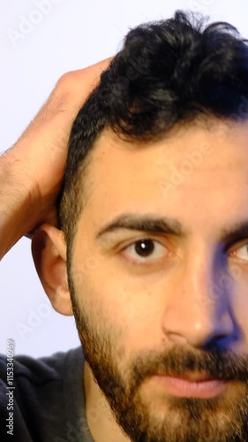 Male Baldness Concern
