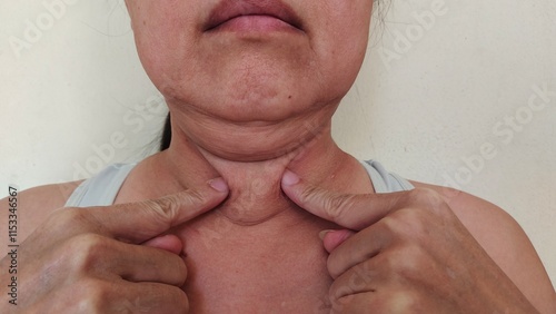 portrait the fingers holding the flabbiness adipose sagging skin under the chin, neck wattle and cellulite, Flabby skin and creases, scar and loose under the neck of the woman, health care and beauty. photo