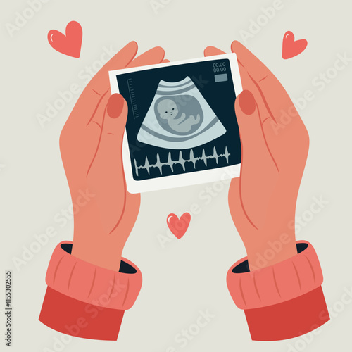 Hands holding a photo of a baby on an ultrasound in the womb. Ultrasound of a baby. Pregnancy. Cartoon vector illustration