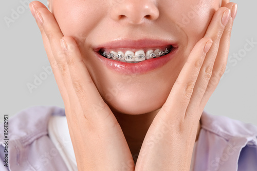 Young woman with dental braces smiling on light background, closeup