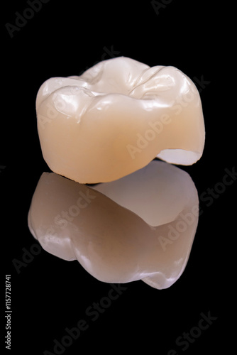 3d printed emax ceramic full crowns