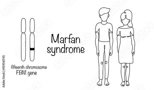 Marfan syndrome