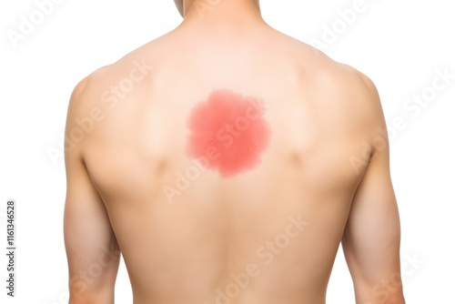 A close-up of a man's bare back with a red flower-shaped mark.