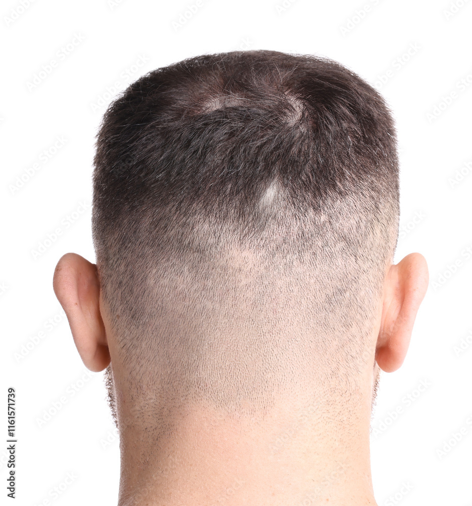 Obraz premium Man suffering from baldness on white background, back view
