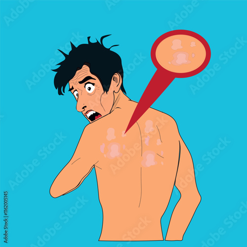 illustration of a man who is shocked to see his back and shoulders full of ringworm. suffering from ringworm or Dermatophytosis, a fungal infection. skin disease. health problems.