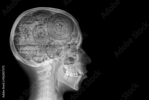artificial intelligence x-ray