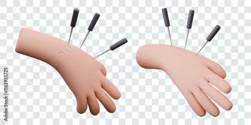 3D hand with special medical needles. Set of isolated templates for dynamic acupuncture concepts