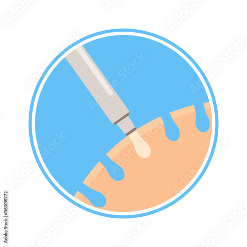Channel opening hair transplantation step