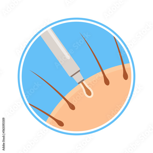 Punch incision hair transplantation step