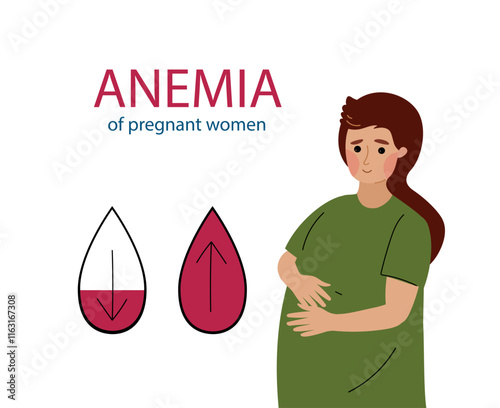 Pregnant women suffer from anemia. Anemia pregnancy infographic. Hypoglycemia concept. disease, Prevention. Vector illustration hand drawn flat