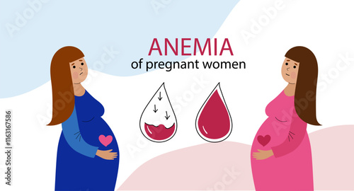 Pregnant women suffer from anemia. Anemia pregnancy infographic. Hypoglycemia concept. disease, Prevention. Vector illustration hand drawn flat