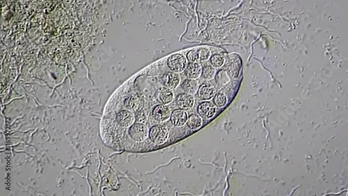 Protozoa and spirochetes under microscopy view  photo