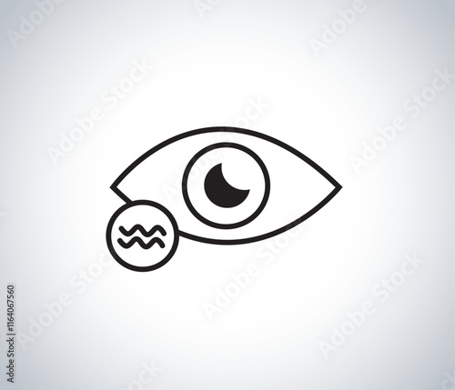  Watery eyes, also known as epiphora or excessive tearing, occur when there is an overproduction of tears or improper drainage of tears