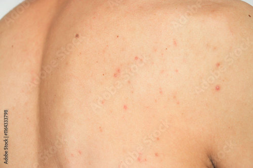 close up of a body skin disease 