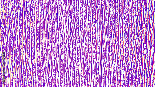 Pseudostratified columnar epithelium of nasal mucosa photo