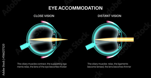 Eye accommodation poster