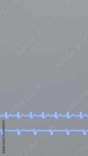 ECG of cardiac arrhythmias. Right bundle branch block and left bundle branch block. photo