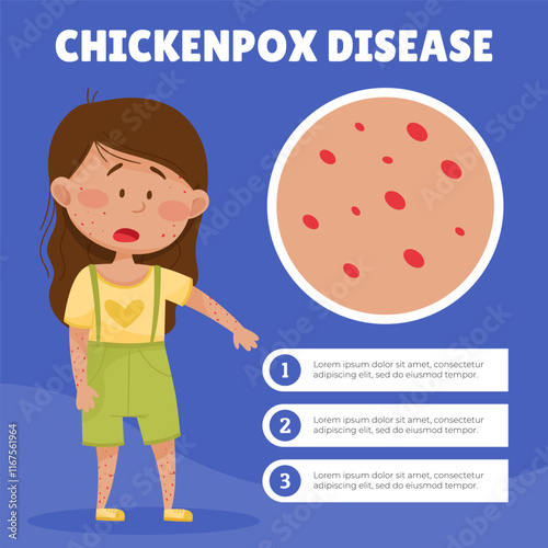 Sick Girl with Chickenpox Feel Unwell and Unhealthy Banner Design Vector Template