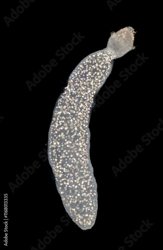 Cyctacanth stage (Acanthocephala) fish cestode larva (Trianchoratus sp.) in Channa striata under the microscope in Lab. photo