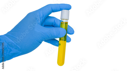 an Erlenmeyer flask containing a blue liquid, likely a chemical solution, on a white background. The flask's shape and the vibrant color of the liquid suggest it may be used in a laboratory setting photo