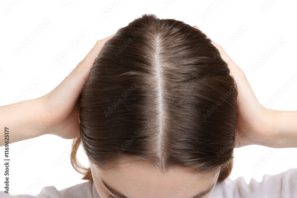 Girl with hair loss problem on white background, closeup Girl with hair loss problem on white background, closeup