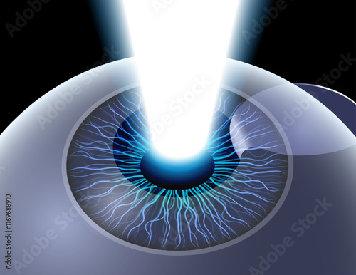 LASIK eye surgery