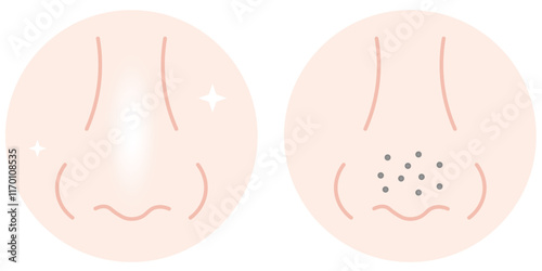 skin pores on human nose before and after illustration. normal pores and blackhead pores