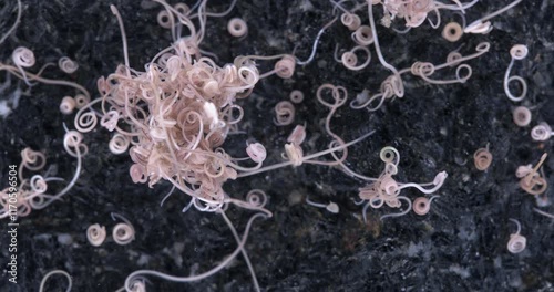 worm Nematoda Pontonema vulgare under microscope, family Oncholaimidae. Found in silted soil, under stones, in algae tangles. White Sea photo