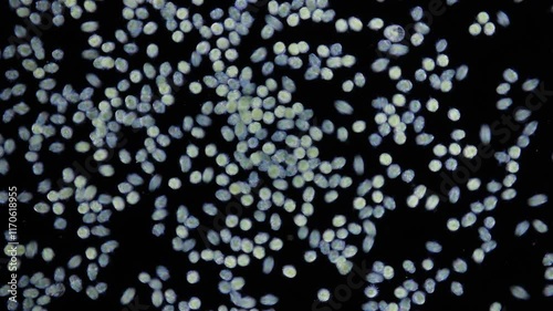 Larvae of a polychaete worm Phyllodoce sp. at trochophore stage under microscope. Family Phyllodocidae. Larva has a ciliary girdle, thanks to which it swims in water column. White sea