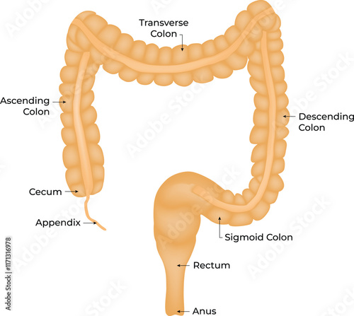 Appendectomy Appendicitis Anatomy Design Vector Illustration