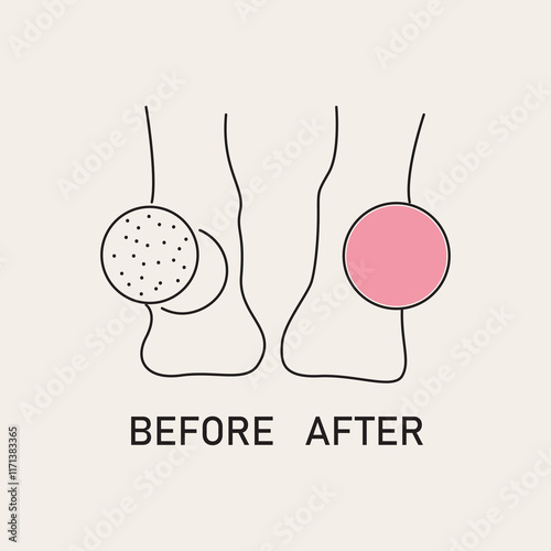 Foot care illustration  Pedicure and exfoliation concept. Vector illustration.