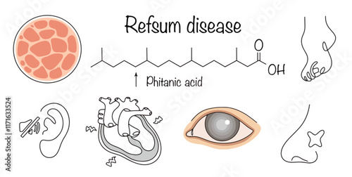 Refsum disease