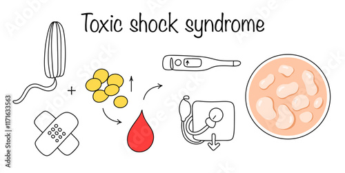 Toxic shock syndrome