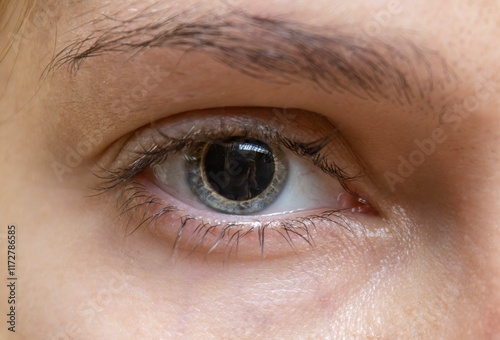 Dilated pupil of a woman's eye photo