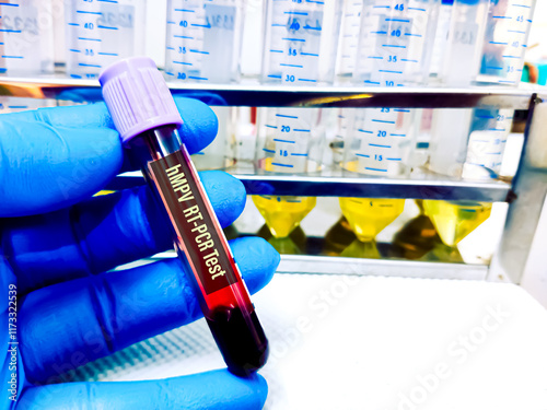 Blood sample for Human Metapneumovirus (hMPV) RT PCR test. Medical healthcare conceptional image. photo