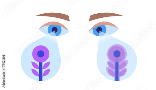 Amblyopia or lazy eye