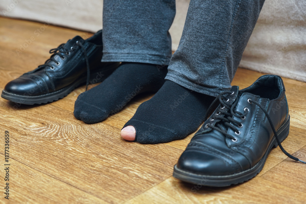 A man's feet in old black socks, one of which has a hole in the big toe A man's feet in old black socks, one of which has a hole in the big toe