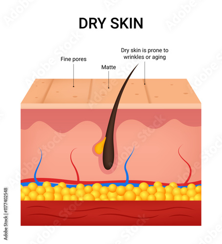 Causes of the Dry Skin