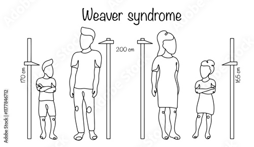 Weaver syndrome