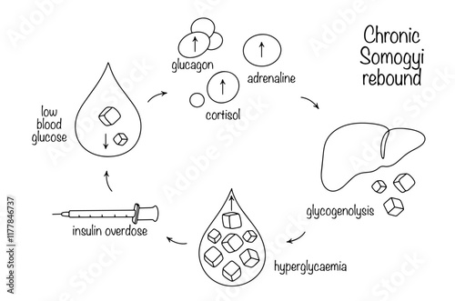 Chronic Somogyi rebound
