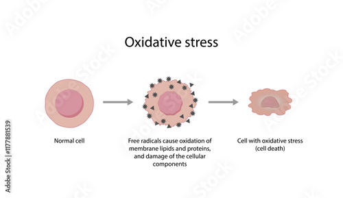 Oxidative stress. Free radicals cause oxidation of the cellular membrane proteins and lipids, and damage of the cellular components. Vector illustration.