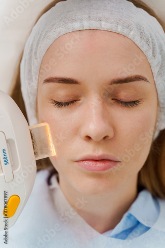 IPL face pigmentation therapy by beautician. Ultrasound laser facial pigmentation treatment in medicine center. Care after skin pigmentation procedure.