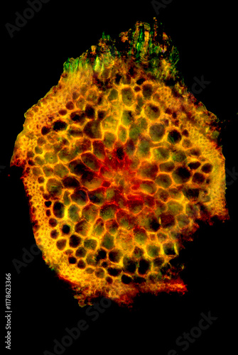 Bright yellow micrograph of a moss stem in transverse section. photo