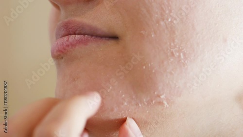 Close up capturing woman gently touching dry, irritated facial skin, highlighting sensitive dermatological skincare texture and complexion issue