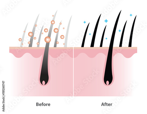 Before and after the mechanism of gray hair coverage shampoo with scalp layer vector illustration isolated on white background. Coloring shampoo, Herbal color serum, hair care concept illustration.