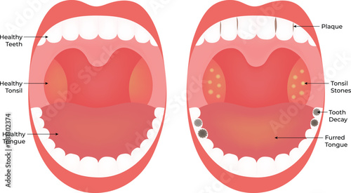 Healthy Teeth Tooth & Deacy Science Design Vector Illustration Diagram
