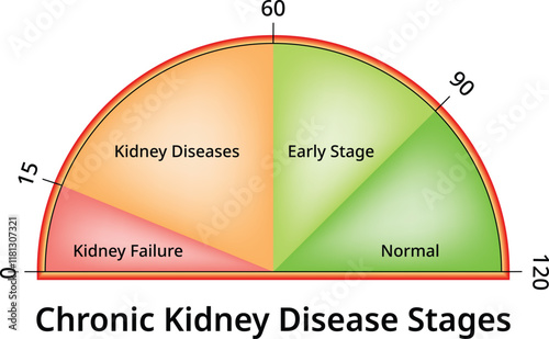 Chronic Kidney Disease Stages Science Design Vector Illustration Diagram