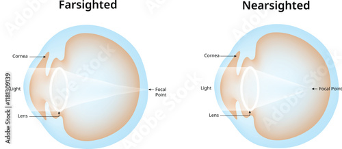 Farsighted Nearsighted Science Design Vector Illustration Diagram