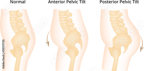 Normal Anterior Pelvic Tilt Posterior Tilt Science Design Vector Illustration Diagram